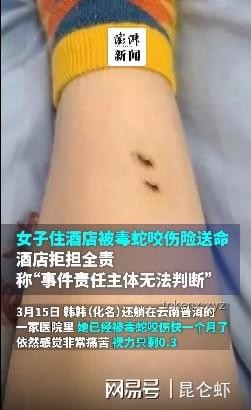 女子被毒蛇咬伤两年后遗症案例研究